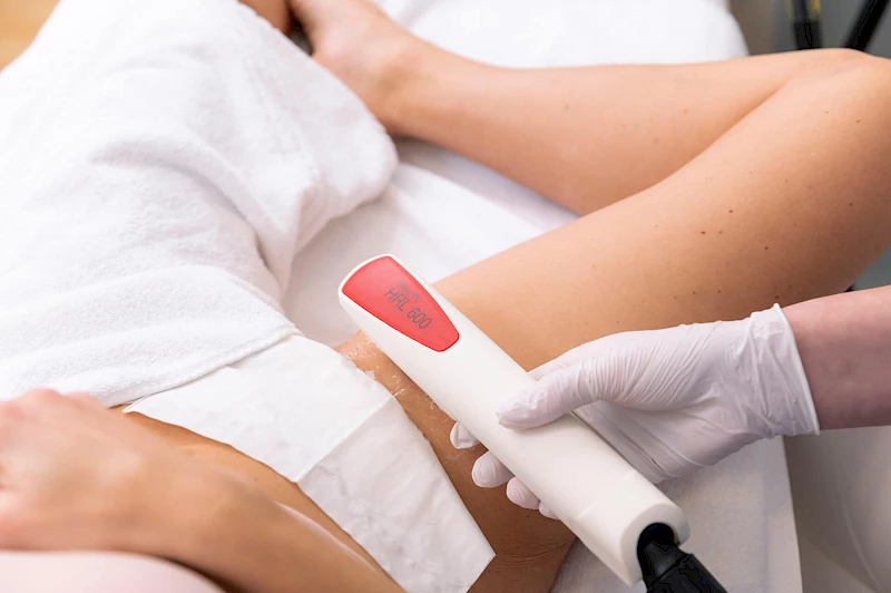 Lasern der Intimzone