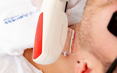 Bereiche Haarentfernung im Gesicht in Erlangen