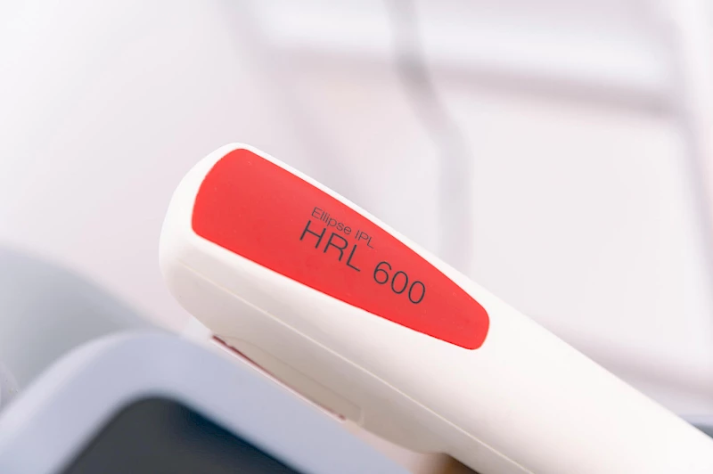 Laser zur Haarentfernung Brust