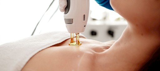 Brusthaare lasern Erlangen