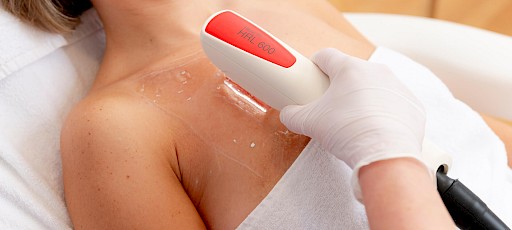 Haarentfernung an der Brust für Frauen in Erlangen