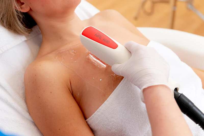 Haarentfernung an der Brust für Frauen in Erlangen