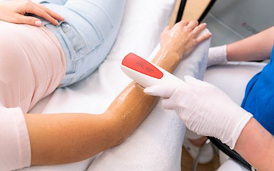 Armhaare entfernen in Erlangen