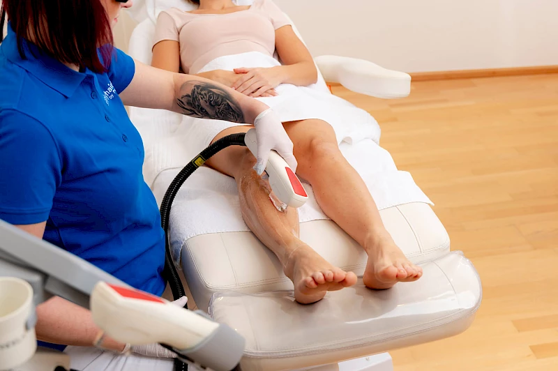 Dauerhafte Haarentfernung an den Beinen in Erlangen