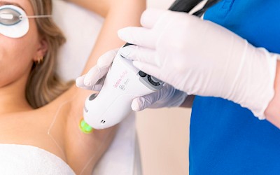 Behandlungsmethoden dauerhafte Haarentfernung