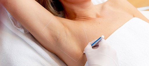 Laser Haarentfernung Frankfurt (Oder)