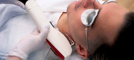 Dauerhafte Haarentfernung Gesicht Frankfurt am Main