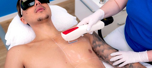 Brusthaare entfernen Frankfurt