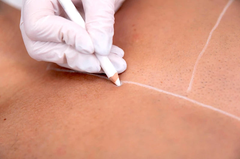 Vorbereitung zum Bauchhaare entfernen Frankfurt am Main