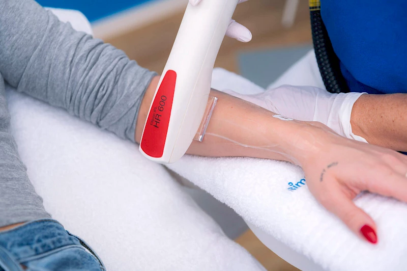 Handhaare entfernen Behandlung