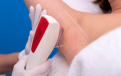 Achselhaare lasern in Frankfurt am Main