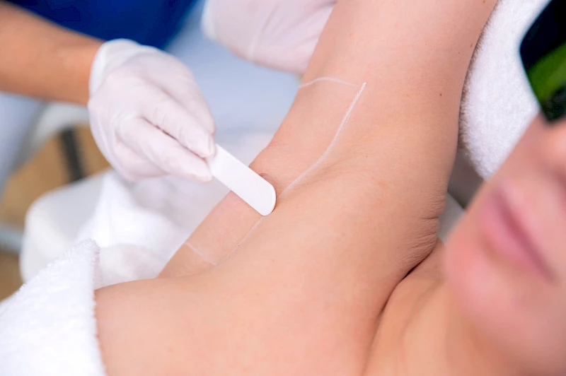 Vorbereitung der Haarentfernung an den Achseln