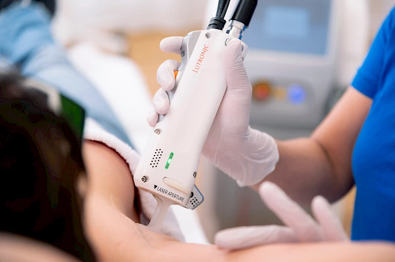 Lasertechnologie Achseln lasern Frankfurt am Main