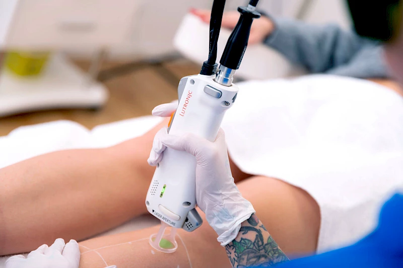 Beine lasern in Frankfurt am Main