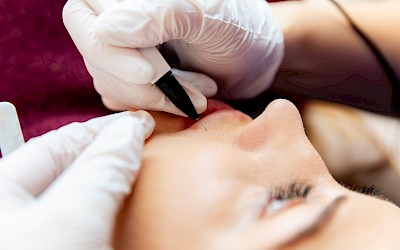 simplyhairless Gesichtsenthaarung