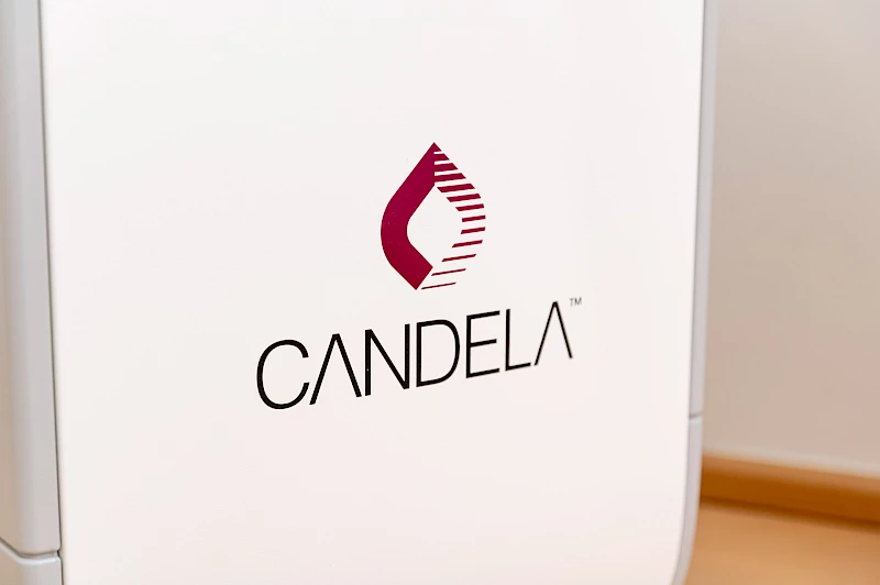 Candela Laser